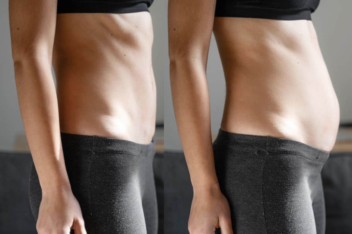 How long does diastasis recti take to improve Reigate?