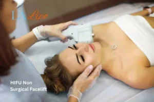 Woman having Hi-Fu to reduce wrinkles Reigate.