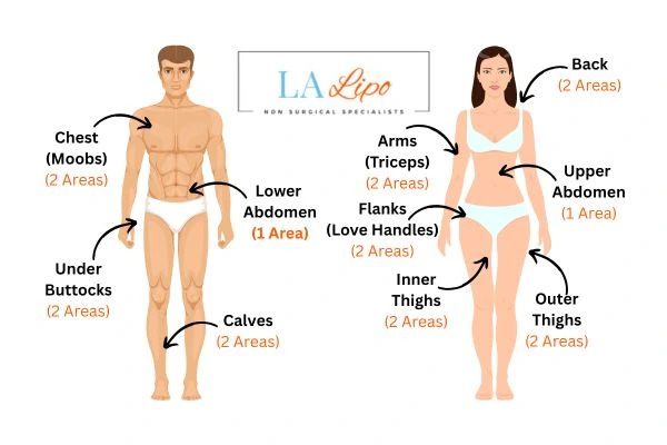 LA LIPO Cryolipolysis Areas Reigate