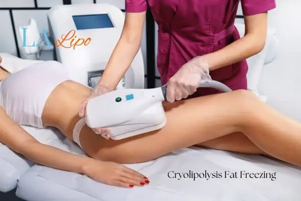 Woman receiving coolsculpting Reigate treatment on her thighs