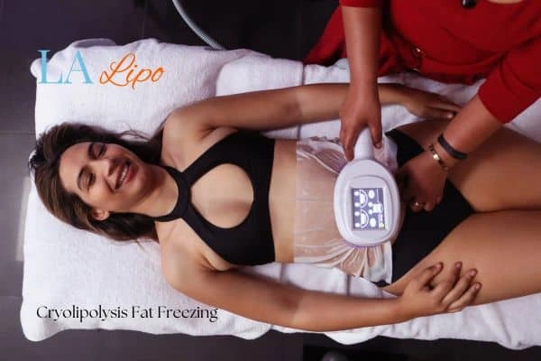 woman getting cryolipolysis Reigate