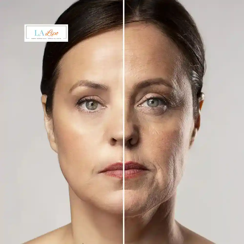 How Can You Tell If Non-Surgical Skin Tightening Is Right for You Reigate?