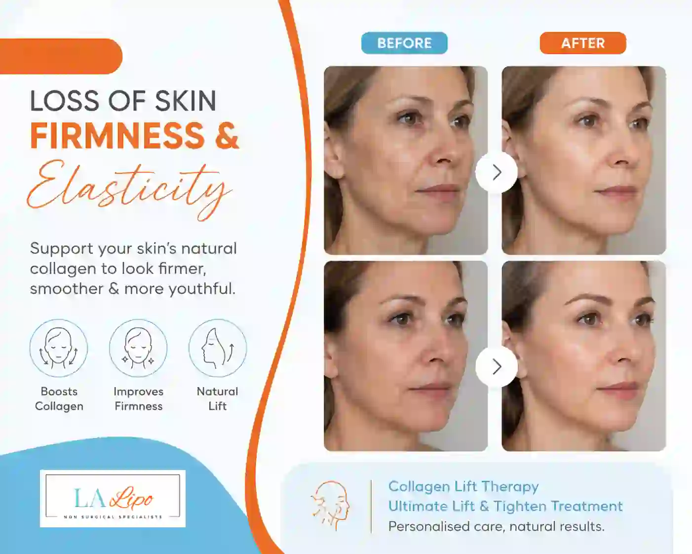 Sign #7: Loss of Skin Firmness and Elasticity Reigate