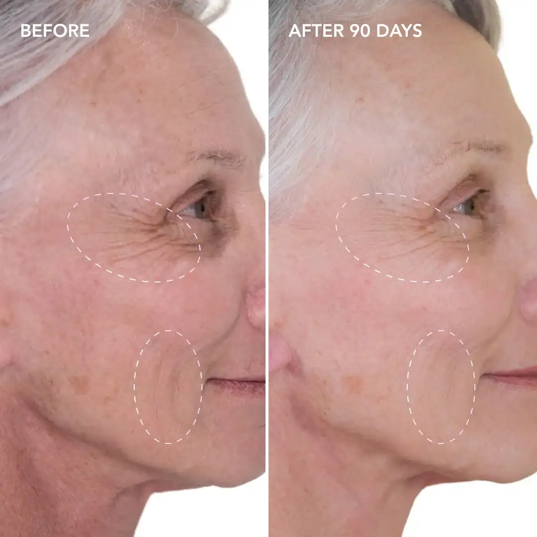 When will you see results Reigate